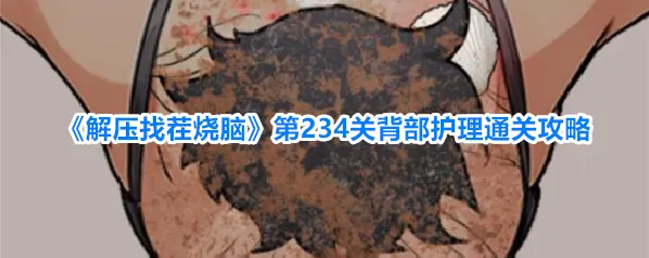 《解压找茬烧脑》第234关背部护理通关攻略